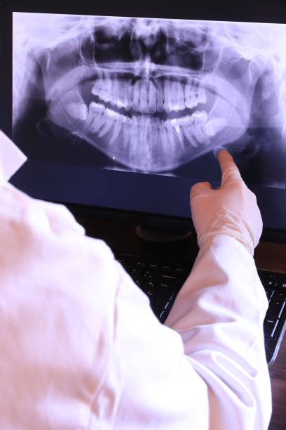 Best Broken or Chipped Tooth Repair in Hoboken, NJ